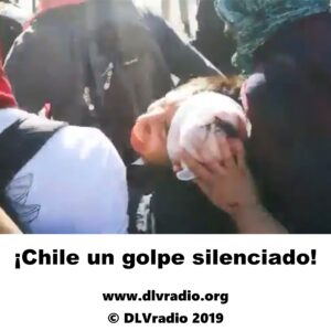 chile2